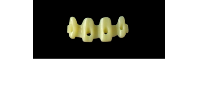 Cod.E22 f Upper Anterior: 10x  hollow pontics blocks-frames, (12-22), carved to fit into wax veneers Cod.E22Upper Anterior, MEDIUM,not arched, (12-22), for porcelain pressed to metal bridgework